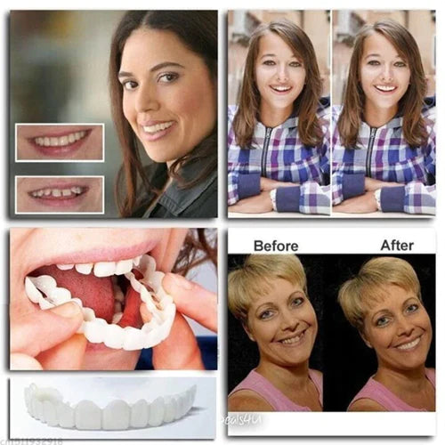🔥LAST DAY Promotion 50% OFF🔥Oveallgo™ Adjustable Snap-On Dentures