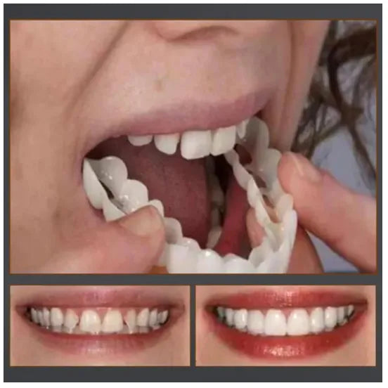 Magic Smile Orthodontics (💥45% OFF) - 🔥Hot Sale